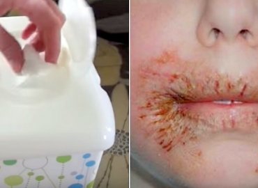 Doctor’s Warning: Never Clean Your Child 