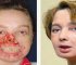 Watch: The World’s First Face Transplant