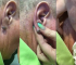 Ear lobe pus ball