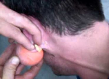 Pimple explodes from the ear, method with egg 