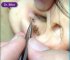 Satisfying Blackhead Removal Pulling Blackheads From An Ear