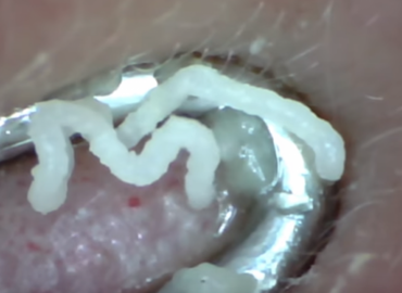 Squeezing Whitehead From Bottomless Pore