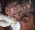 WATCH: Maggots eating up this woman’s head